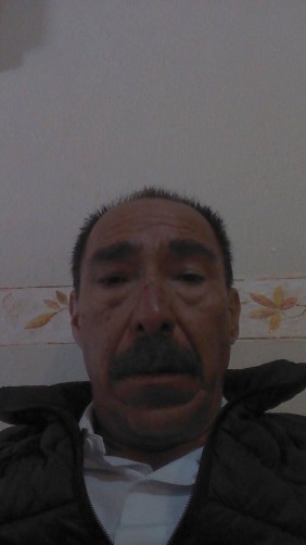Mario Alberto, 61, Mexico City