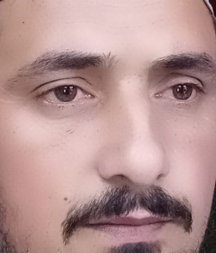 A Ali, 38, Peshawar